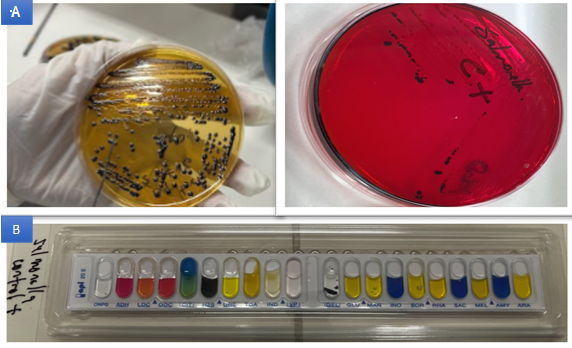 Gráfico, Gráfico de barras

Descripción generada automáticamente